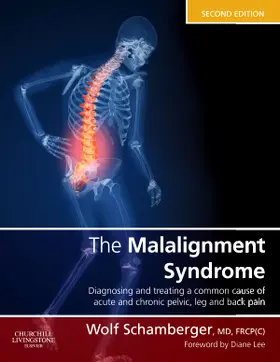 Schamberger |  The Malalignment Syndrome | Buch |  Sack Fachmedien