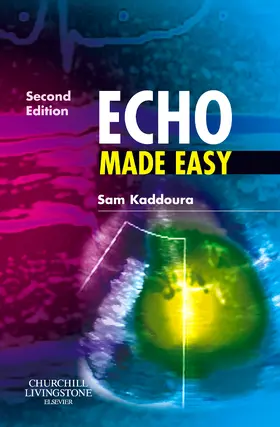 Kaddoura |  Echo Made Easy | Buch |  Sack Fachmedien