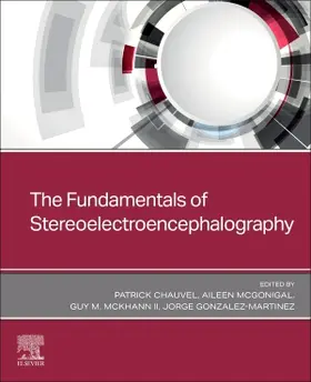 McGonigal / Chauvel / McKhann II |  The Fundamentals of Stereoelectroencephalography | Buch |  Sack Fachmedien
