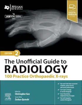 Gee |  The Unofficial Guide to Radiology: 100 Practice Orthopaedic X-rays | Buch |  Sack Fachmedien