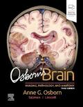 Osborn / Linscott / Salzman |  Osborn's Brain | Buch |  Sack Fachmedien