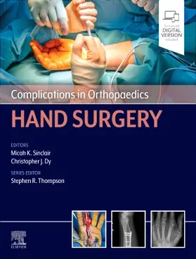Sinclair / Dy |  Complications in Orthopaedics: Hand Surgery | Buch |  Sack Fachmedien