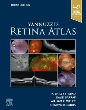 Freund / Sarraf / Mieler |  Yannuzzi's Retina Atlas | Buch |  Sack Fachmedien