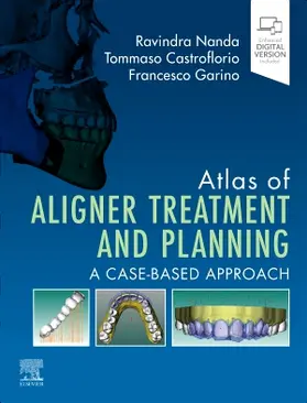 Nanda / Castroflorio / Garino |  Atlas of Aligner Treatment and Planning | Buch |  Sack Fachmedien