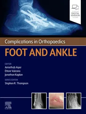 Aiyer / Vulcano / Kaplan |  Complications in Orthopaedics: Foot and Ankle | Buch |  Sack Fachmedien