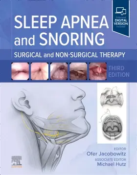 Jacobowitz | Sleep Apnea and Snoring | Buch | 978-0-443-12563-8 | www.sack.de
