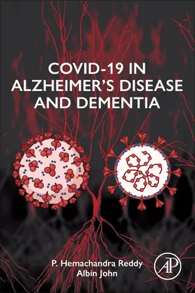 Reddy / John | Covid-19 in Alzheimer's Disease and Dementia | Buch | 978-0-443-15256-6 | sack.de