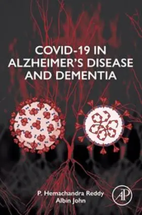 Reddy / John | COVID-19 in Alzheimer's Disease and Dementia | E-Book | sack.de