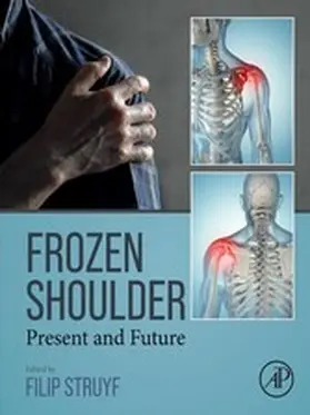 Struyf |  Frozen Shoulder | eBook | Sack Fachmedien