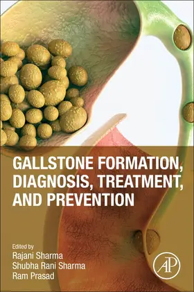 sharma / Prasad |  Gallstone Formation, Diagnosis, Treatment and Prevention | Buch |  Sack Fachmedien