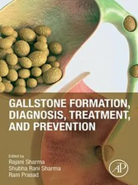 Sharma / Prasad | Gallstone Formation, Diagnosis, Treatment and Prevention | E-Book | www.sack.de