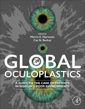 Burkat |  Global Oculoplastics | Buch |  Sack Fachmedien