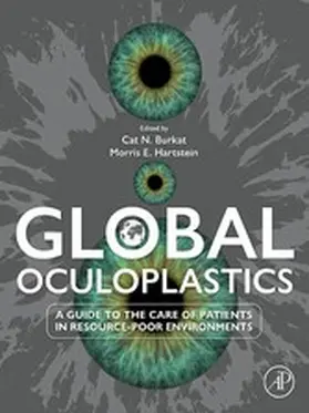 E Hartstein / Burkat |  Global Oculoplastics | eBook | Sack Fachmedien