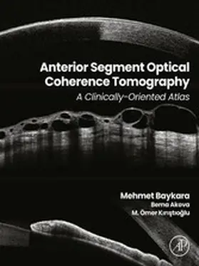 Baykara / Akova / Kiristioglu | Anterior Segment Optical Coherence Tomography | E-Book | www.sack.de