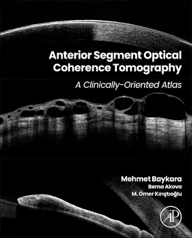 Baykara / Akova / Kiristioglu |  Anterior Segment Optical Coherence Tomography | Buch |  Sack Fachmedien