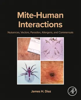 Diaz | Mite-Human Interactions | Buch | 978-0-443-23524-5 | www.sack.de