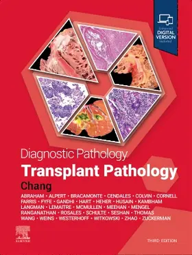 Chang | Diagnostic Pathology: Transplant Pathology | Buch | 978-0-443-25008-8 | www.sack.de