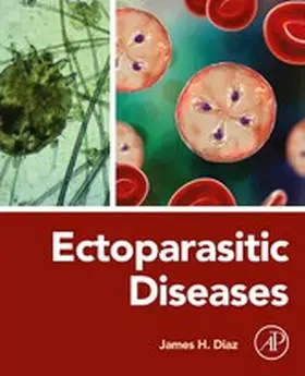 Diaz MD | Ectoparasitic Diseases | E-Book | www.sack.de