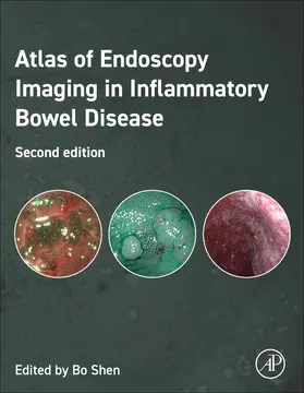 Shen |  Atlas of Endoscopy Imaging in Inflammatory Bowel Disease | Buch |  Sack Fachmedien
