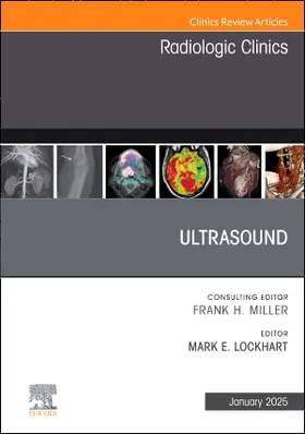 Lockhart |  Ultrasound, an Issue of Radiologic Clinics of North America | Buch |  Sack Fachmedien