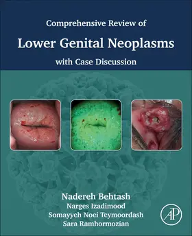 Behtash / Izadimood / Ramhormozian |  Comprehensive Review of Lower Genital Neoplasms | Buch |  Sack Fachmedien