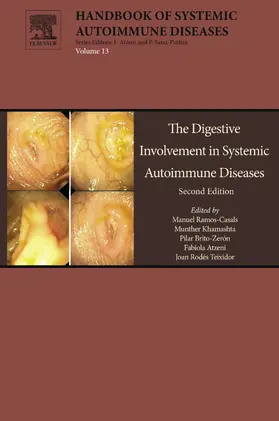 Ramos-Casals / Khamashta MD / Khamashta | The Digestive Involvement in Systemic Autoimmune Diseases | E-Book | sack.de