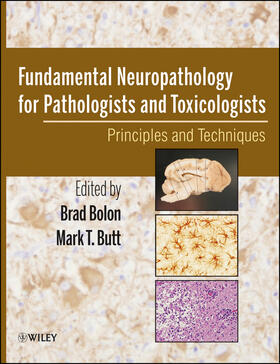 Bolon / Butt | Fundamental Neuropathology for Pathologists and Toxicologists | Buch | 978-0-470-22733-6 | sack.de