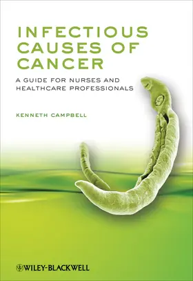 Campbell |  Infectious Causes of Cancer | Buch |  Sack Fachmedien