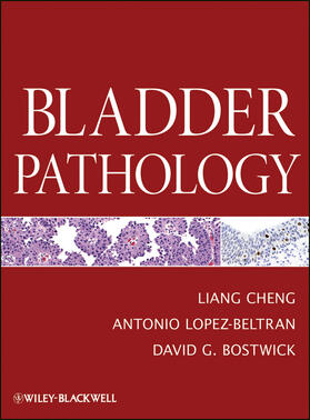 Cheng / Lopez-Beltran / Bostwick | Bladder Pathology | Buch | 978-0-470-57108-8 | sack.de