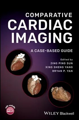 Sun / Yang / Yan |  Comparative Cardiac Imaging | Buch |  Sack Fachmedien