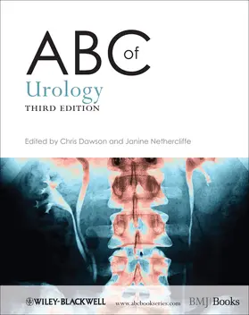 Dawson / Nethercliffe |  ABC of Urology | Buch |  Sack Fachmedien