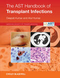 Kumar / Humar |  The Ast Handbook of Transplant Infections | Buch |  Sack Fachmedien