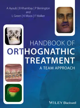 Ayoub / Khambay / Benington | Handbook of Orthognathic Treatment | Buch | 978-0-470-65905-2 | sack.de