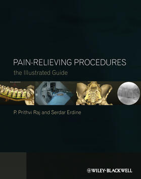 Raj / Erdine | Pain-Relieving Procedures | Buch | 978-0-470-67038-5 | sack.de