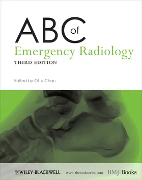 Chan | ABC of Emergency Radiology | Buch | 978-0-470-67093-4 | sack.de