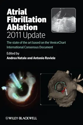 Natale / Raviele |  Atrial Fibrillation Ablation, 2011 Update | Buch |  Sack Fachmedien