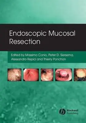 Conio / Siersema / Repici |  Endoscopic Mucosal Resection | eBook | Sack Fachmedien