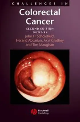 Scholefield / Abcarian / Maughan |  Challenges in Colorectal Cancer | eBook | Sack Fachmedien