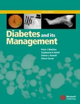 Watkins / Amiel / Howell |  Diabetes and Its Management | eBook | Sack Fachmedien