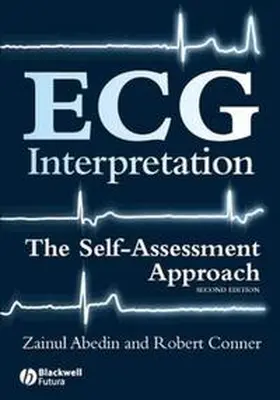Abedin / Conner |  ECG Interpretation | eBook | Sack Fachmedien