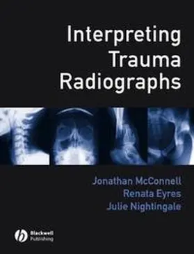 Mcconnell / Eyres / Nightingale |  Interpreting Trauma Radiographs | eBook | Sack Fachmedien