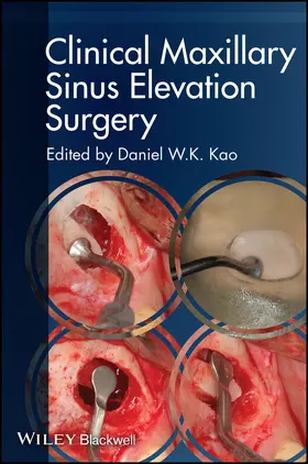 Kao |  Clinical Maxillary Sinus Elevation Surgery | Buch |  Sack Fachmedien