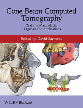 Sarment | Cone Beam Computed Tomography | Buch | 978-0-470-96140-7 | sack.de