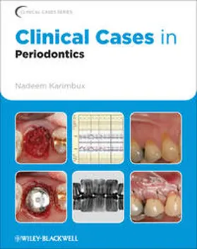Karimbux |  Clinical Cases in Periodontics | eBook | Sack Fachmedien