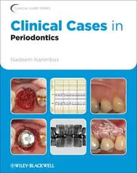 Karimbux |  Clinical Cases in Periodontics | eBook | Sack Fachmedien