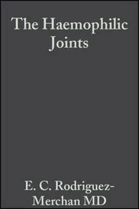 Rodriguez-Merchan |  The Haemophilic Joints | eBook | Sack Fachmedien