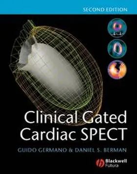 Germano / Berman |  Clinical Gated Cardiac SPECT | eBook | Sack Fachmedien