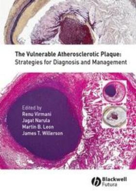 Virmani / Narula / Leon | The Vulnerable Atherosclerotic Plaque | E-Book | sack.de