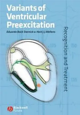 Back Sternick / Wellens |  Variants of Ventricular Preexcitation | eBook | Sack Fachmedien