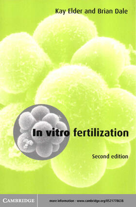 Elder |  In Vitro Fertilization | eBook | Sack Fachmedien